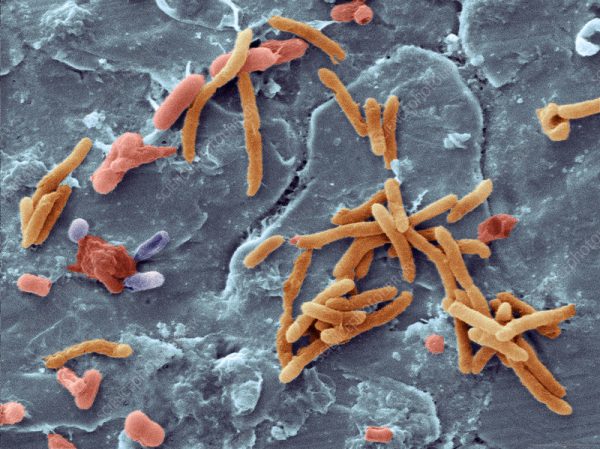 Microscopic view of bacteria present in raw meat